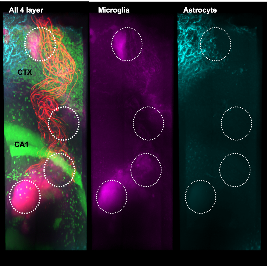 Immune Response Minimization in Neural Interface Design